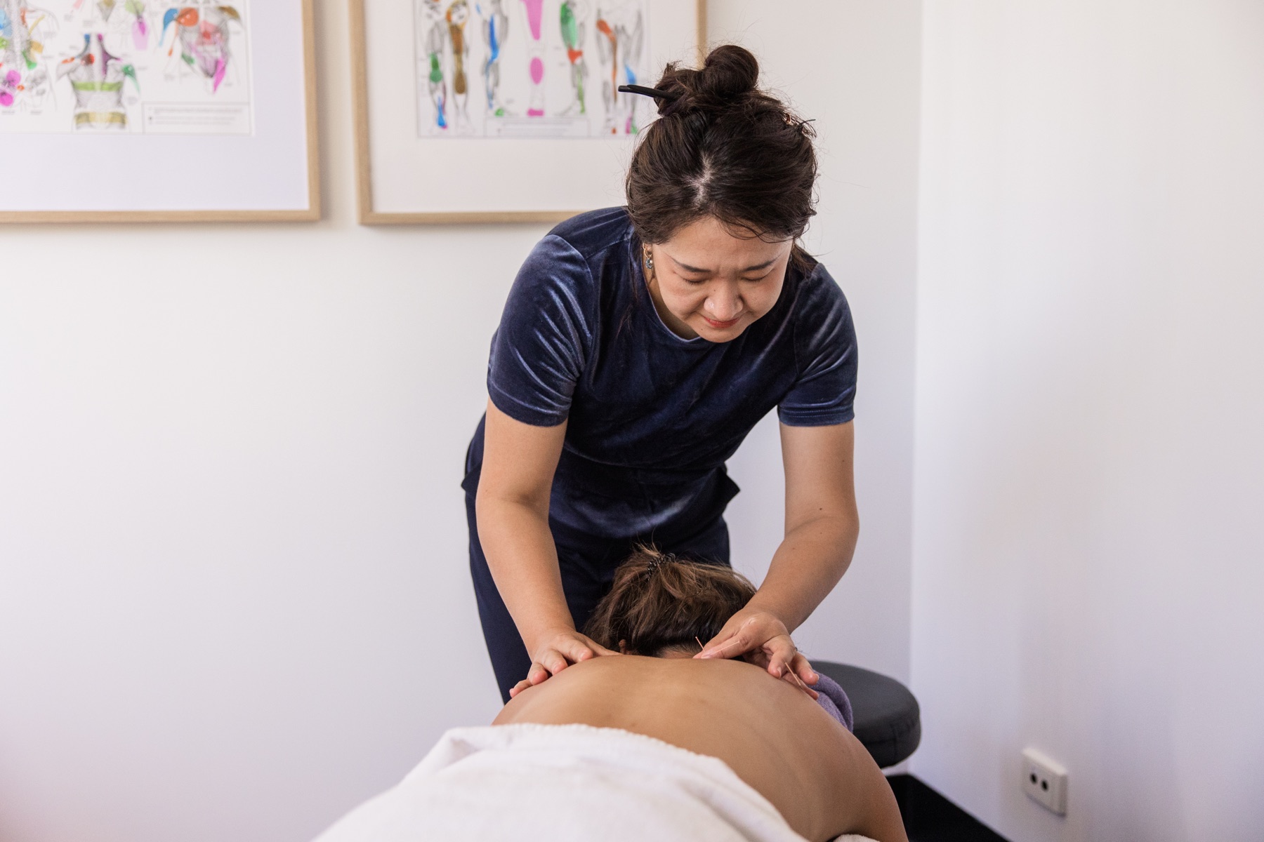 Sienna providing dry needling treatment in clinic
